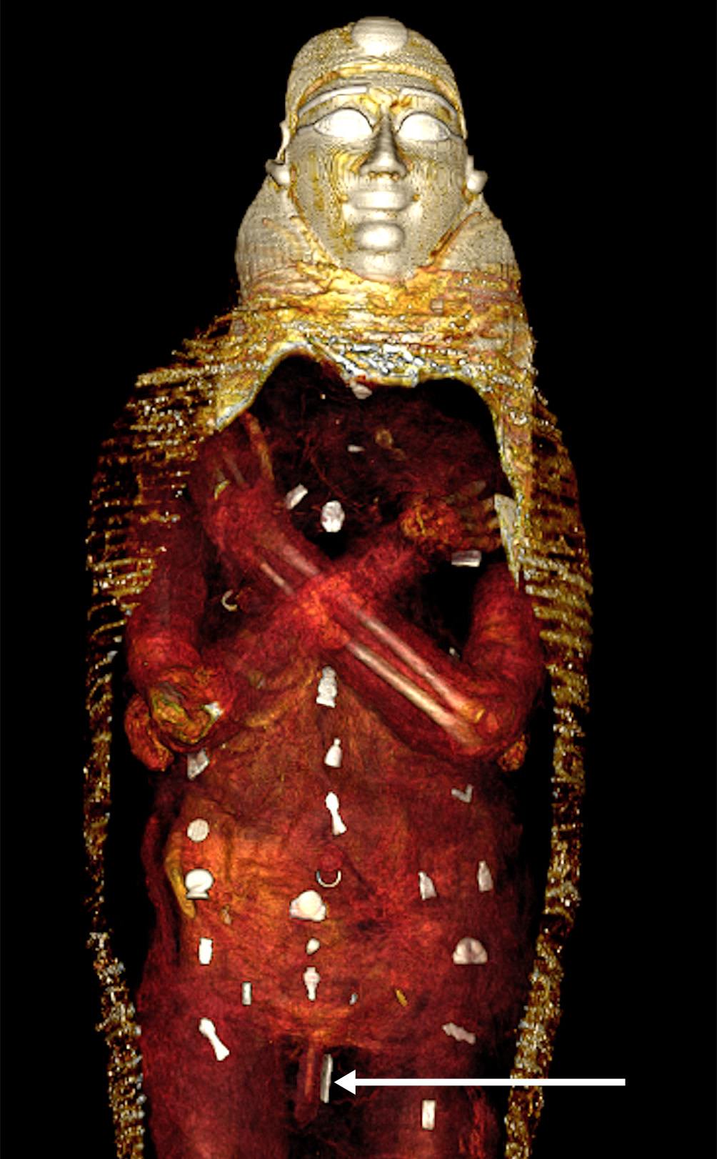 Medical Mummy