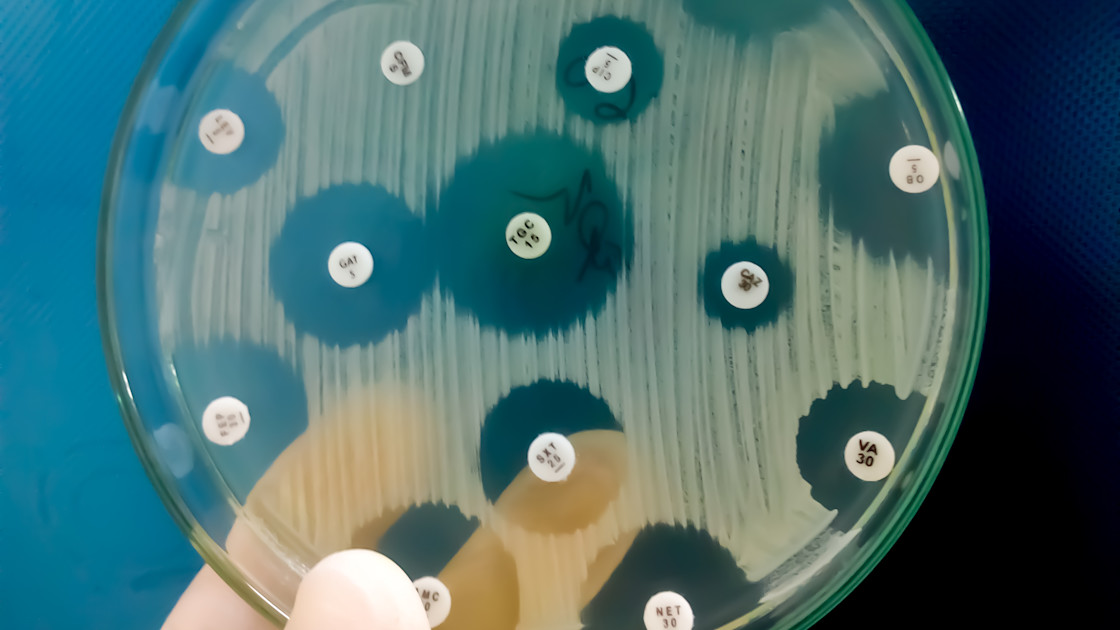 Chemikalien aus Kurkuma und Rhabarber könnten im Abwasser zur Bekämpfung ...