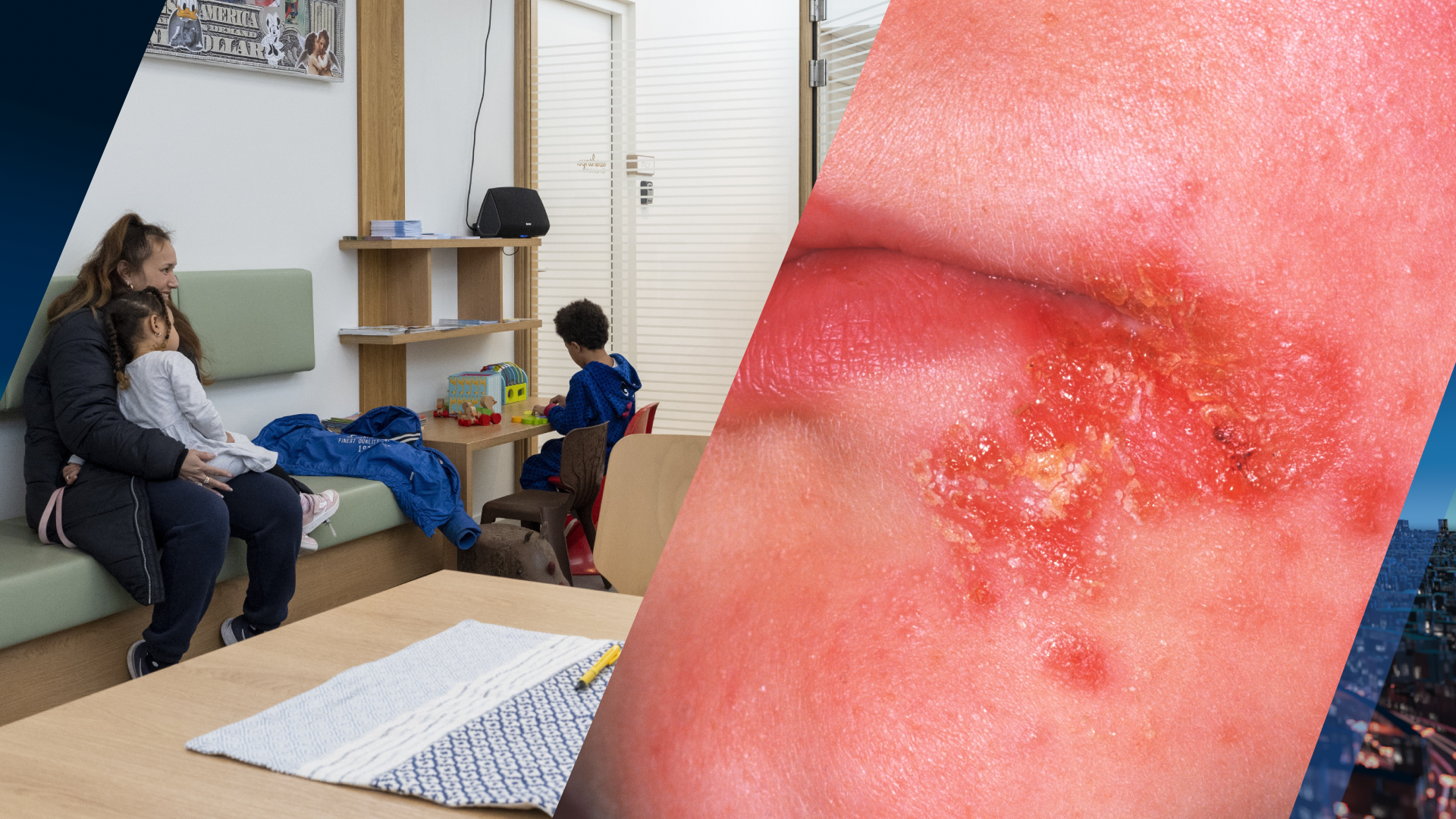 カラントのあごひげが子供の周りをつかむ：一般的な訪問の大きなピーク