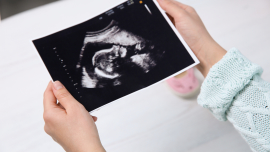 Person holding ultrasound image