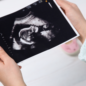 Person holding ultrasound image