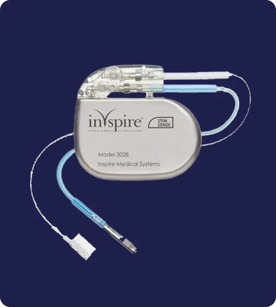 Inspire Sleep Apnea Innovation - Obstructive Sleep Apnea Treatment