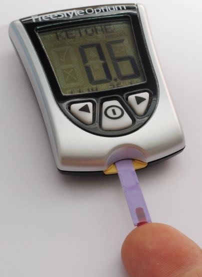 Ketosis Test