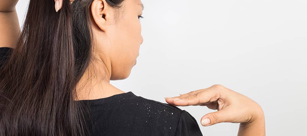 Er valt roos van het hoofd op de schouder van een mevrouw