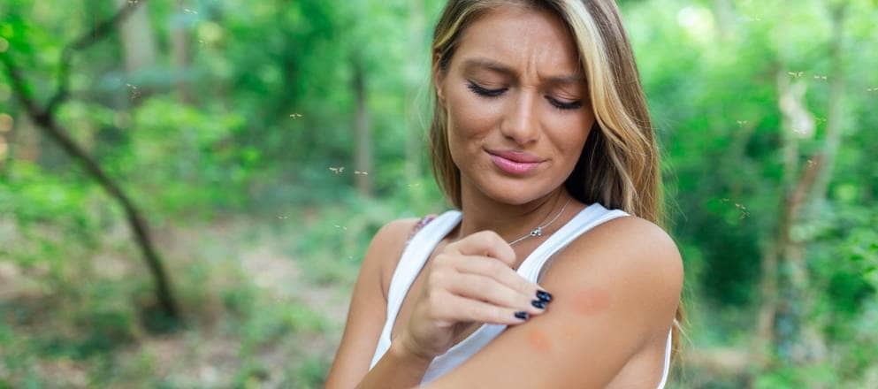 vrouw met hooikoorts jeukt haar arm