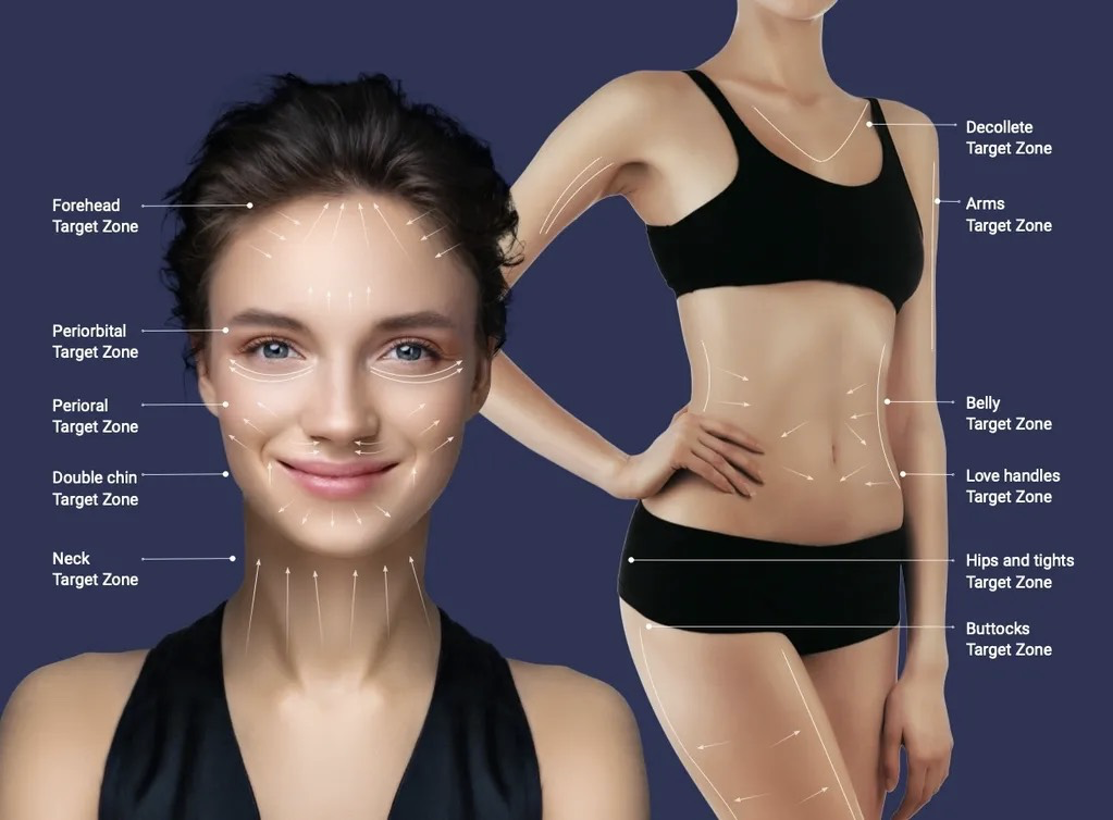 Ultraformer MPT - wskazania