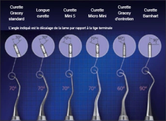 La figure 60 montre différentes pointes de six curettes en gros plans