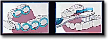 Tooth Brushing Technique - Figure 1