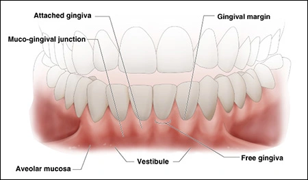 healthy gingiva