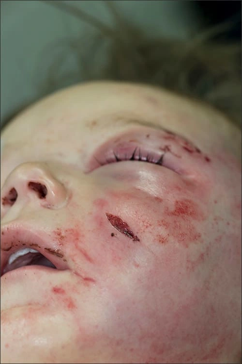 Photo montrant les blessures au visage d’un enfant victime de sévices