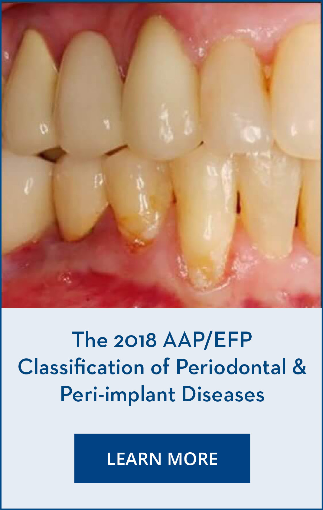 [EN] - Generic Page - Implementing the AAP/EFP periodontal classification image layout 2