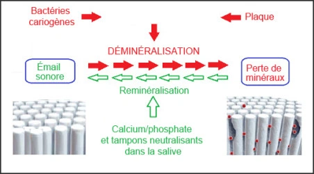 demineralization and remineralization