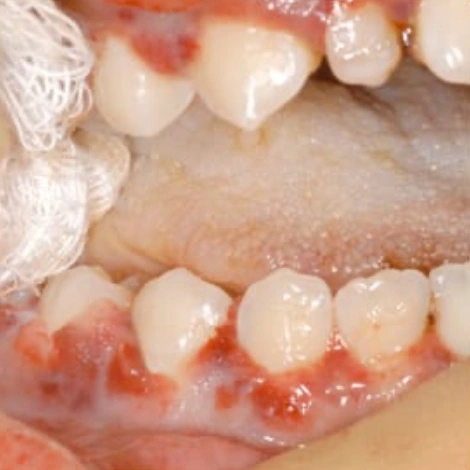 ce110 - A Guide to Clinical Differential Diagnosis of Oral Mucosal Lesions