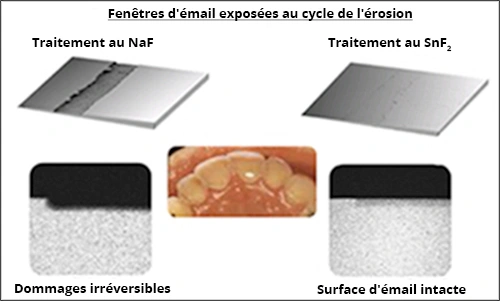 Figure 8. Tester les effets de prévention de l’érosion de différentes sources de fluorure. 
