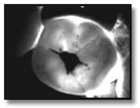 Clinical Images Taken with the DIFOTI - Figure 3