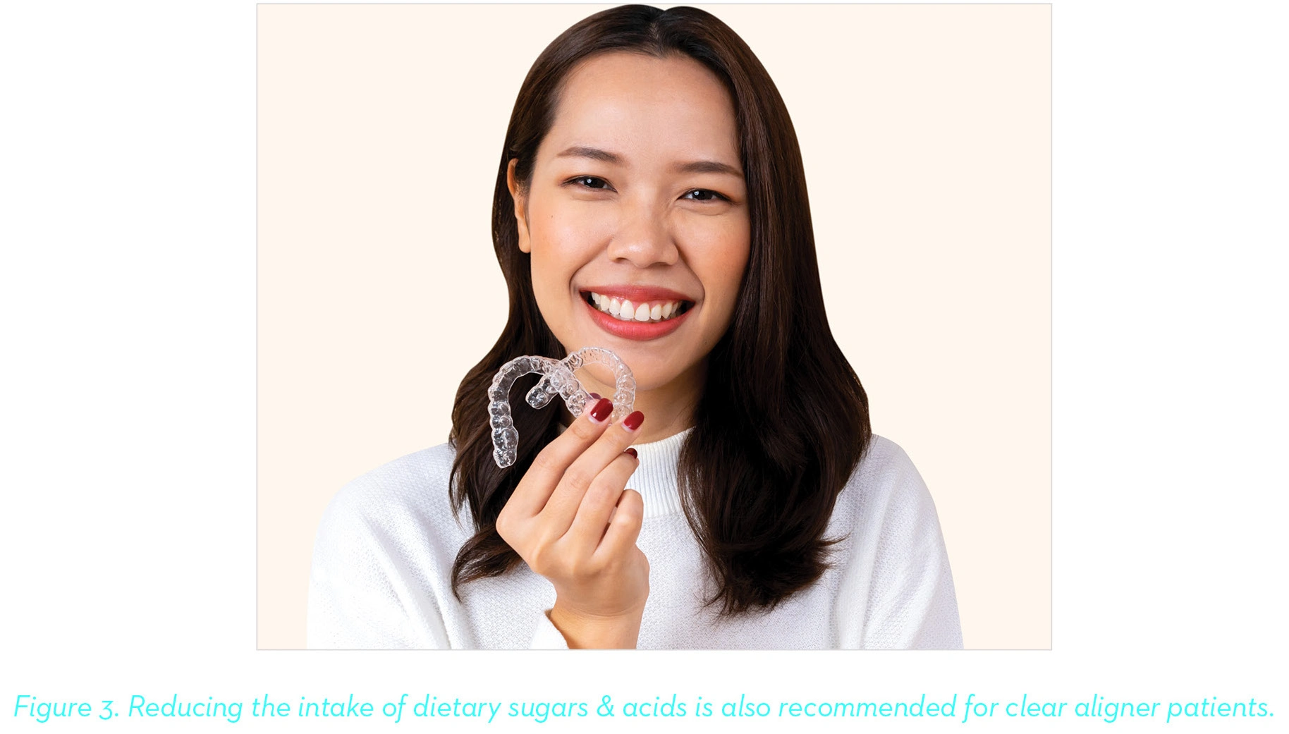 Reducing the intake of dietary sugars & acids is also recommended for clear aligner patients.