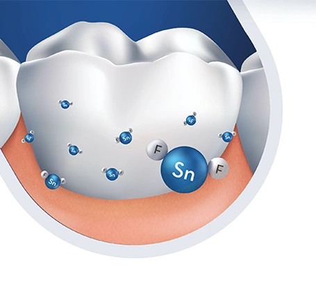 Why Stannous Fluoride