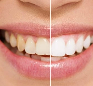 Whitening Image