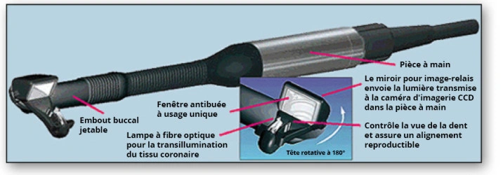 Diagramme de DIFOTI.