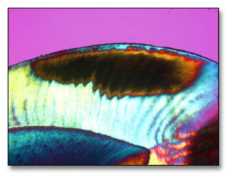 Image illustrant un cliché de micrographie en lumière polarisée d'une lésion précoce de l'émail.
