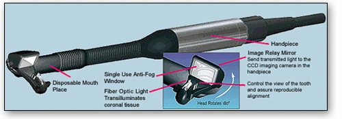 Fiber-Optic Transillumination - Figure 1
