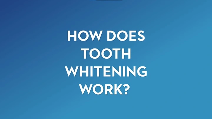 How does tooth whitening work
