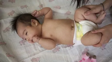 A53 Constipação infantil e as melhores soluções