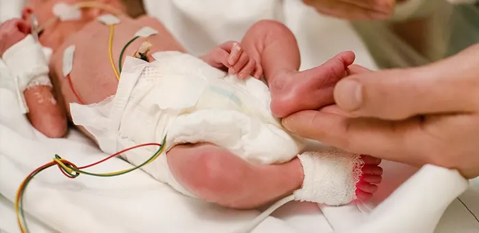 Bebê Prematuro: entenda o que é, suas causas e cuidados