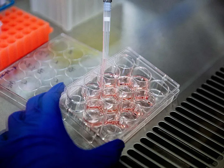 Skeleton ‘gatekeeper’ lining brain cells could guard against Alzheimer’s