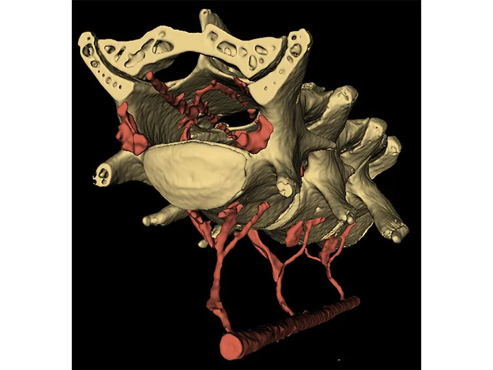 Hydraulic brain: Body motion linked to fluid movement in the brain