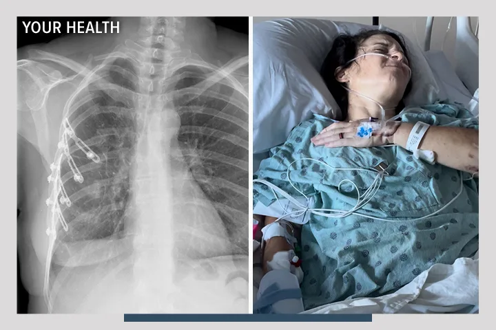 A collage of a bicyclist in a race, an x-ray of rib bones, and a hospital patient in pain. There is an overlay that says Your Health