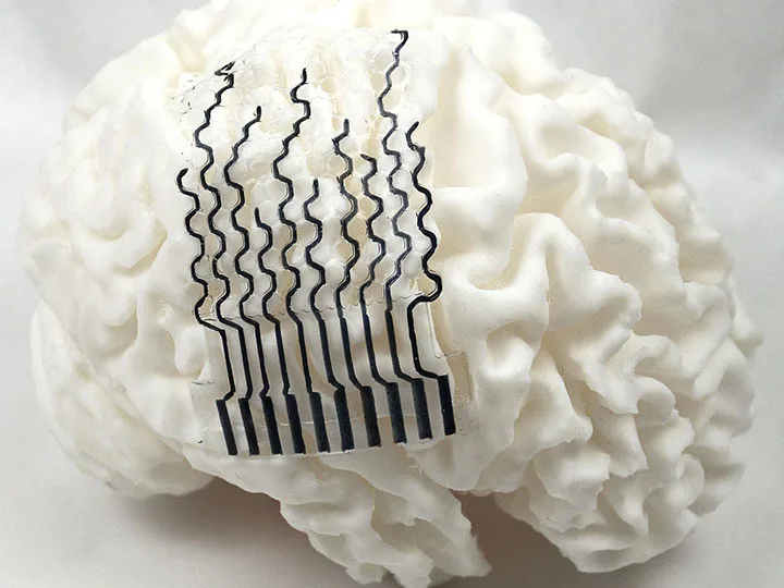 3D-printed brain sensors may unlock personalized neural monitoring