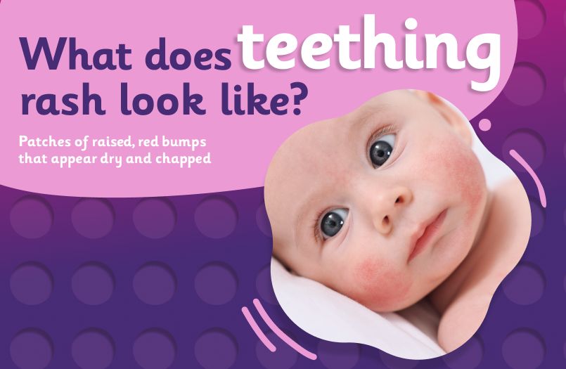 What does teething rash look like?