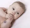 baby-birthmarks