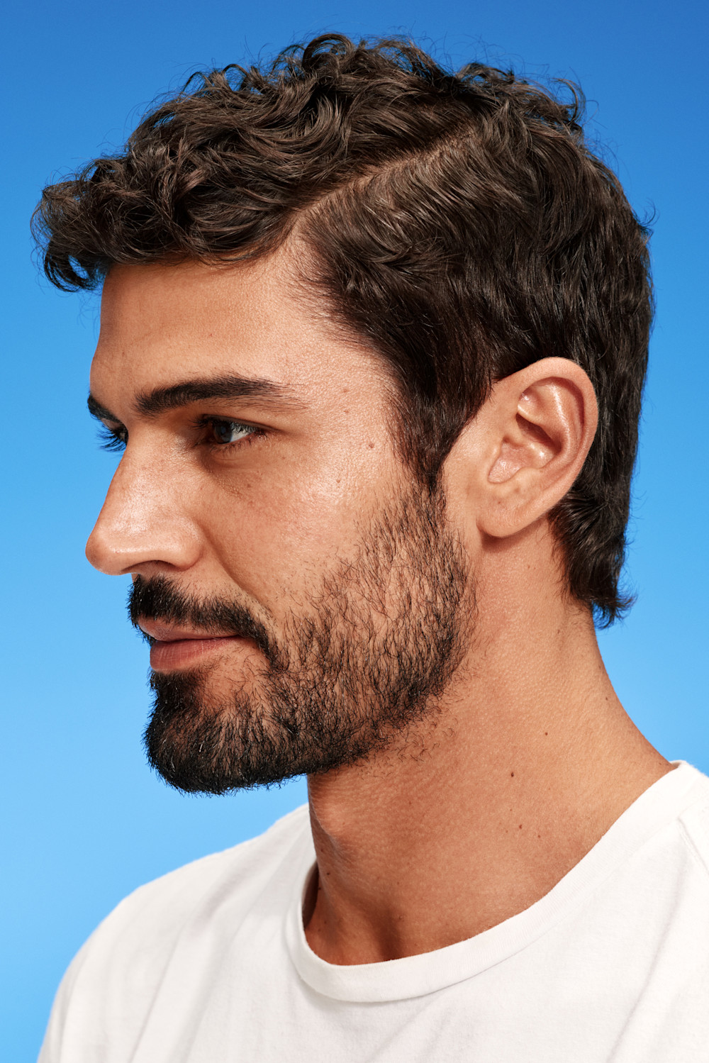 Primer plano de cabello con caspa