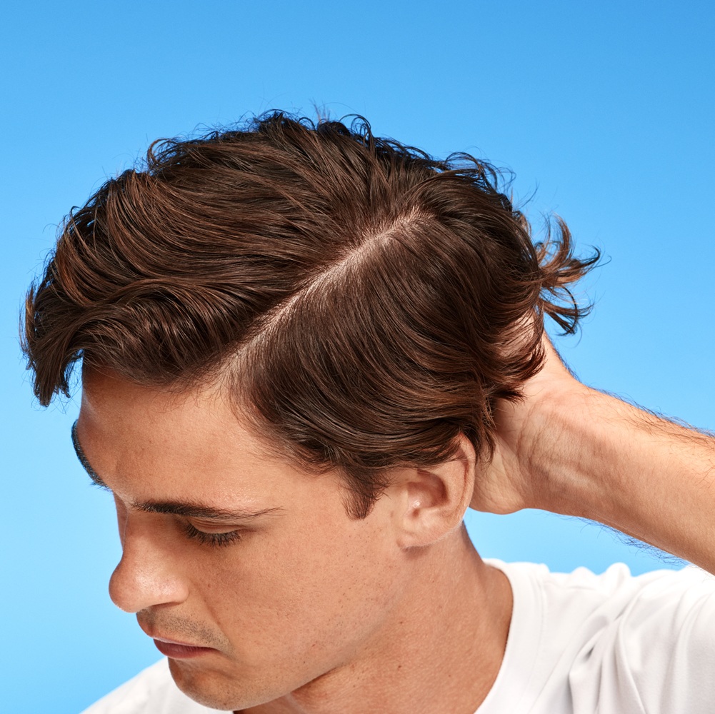 Hombre con la cabeza inclinada se toca el pelo y muestra un cuero cabelludo sano