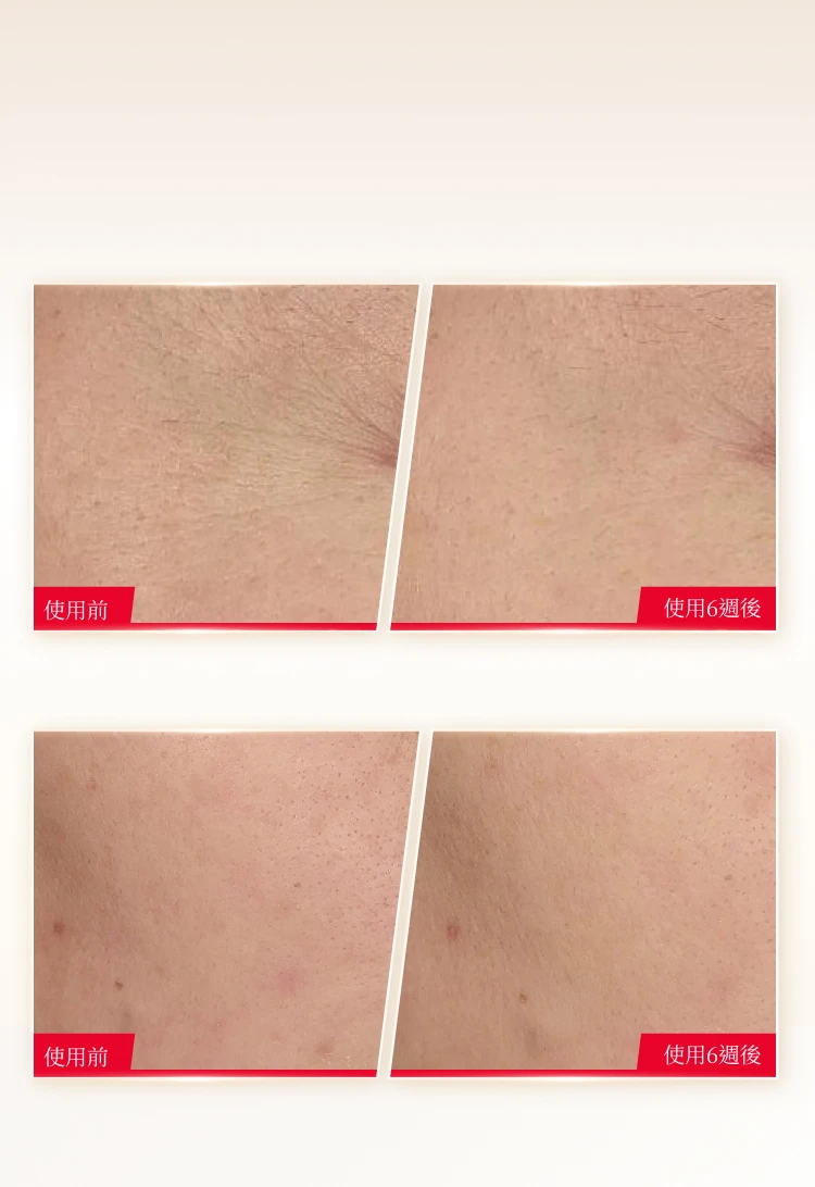 PED - Selene FTS - Skin Layer Differences - BG Image
