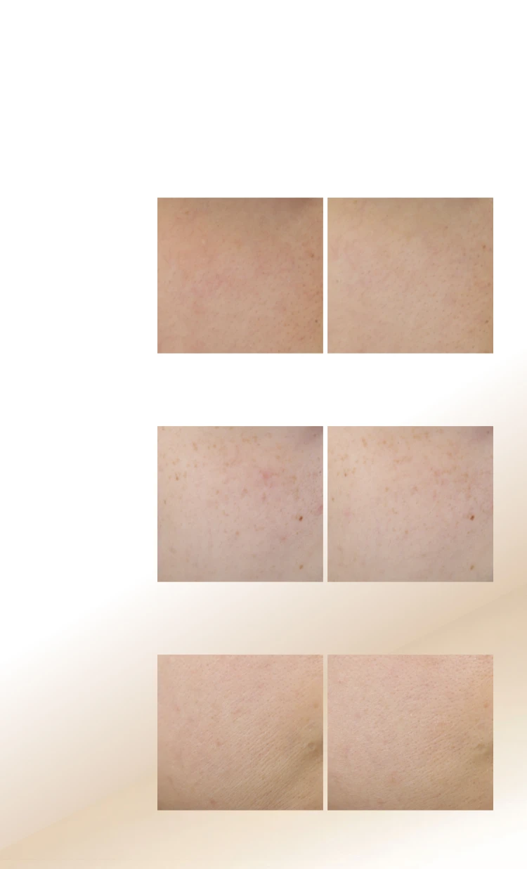 PBC - Skin Chart - BG Image