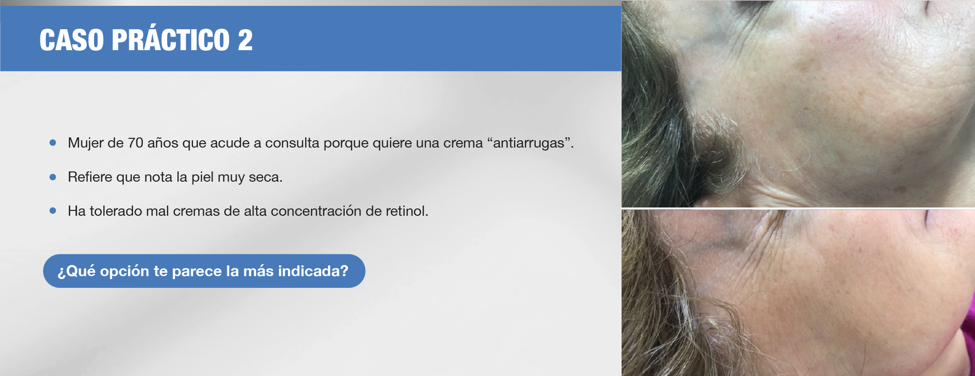 Img-CASO PRÁCTICO 2