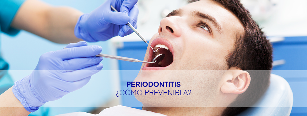 PERIODONTITIS SALUD ORAL HIGIENE BUCODENTAL NOTICIA