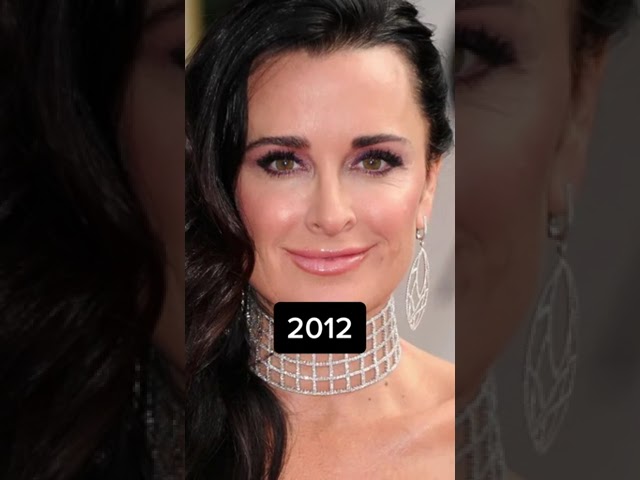 Kyle Richard's changing face throughout the years #shorts 