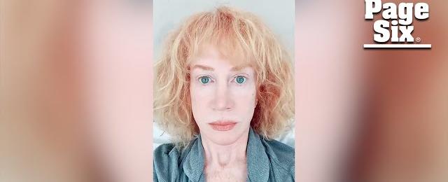 Kathy Griffin diagnosed with ‘extreme case’ of ‘complex PTSD’ after MRI
