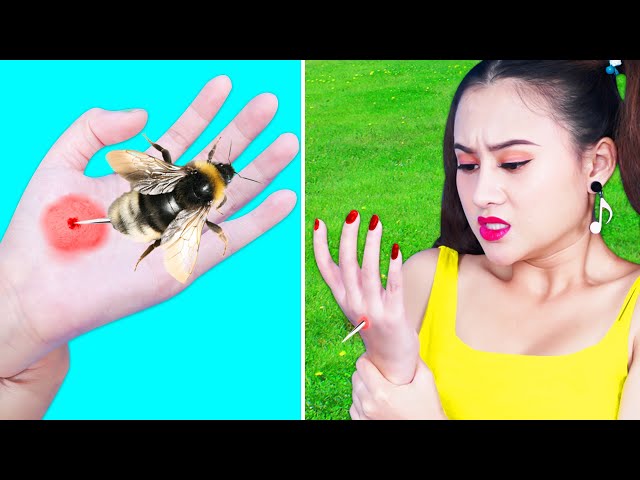 Top Emergency Life Hacks & Remedies | Crazy DIY Tips & Crafty Tricks BY T-FUN