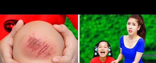 Best parenting tips and tricks for emergencies | Smart life hack for parents By T-FUN