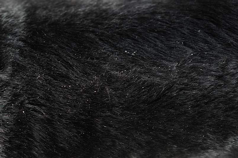 A close-up picture of dandruff on a dark coat. 