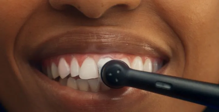 D Tooth Sensitivity and Gum Sensitivity