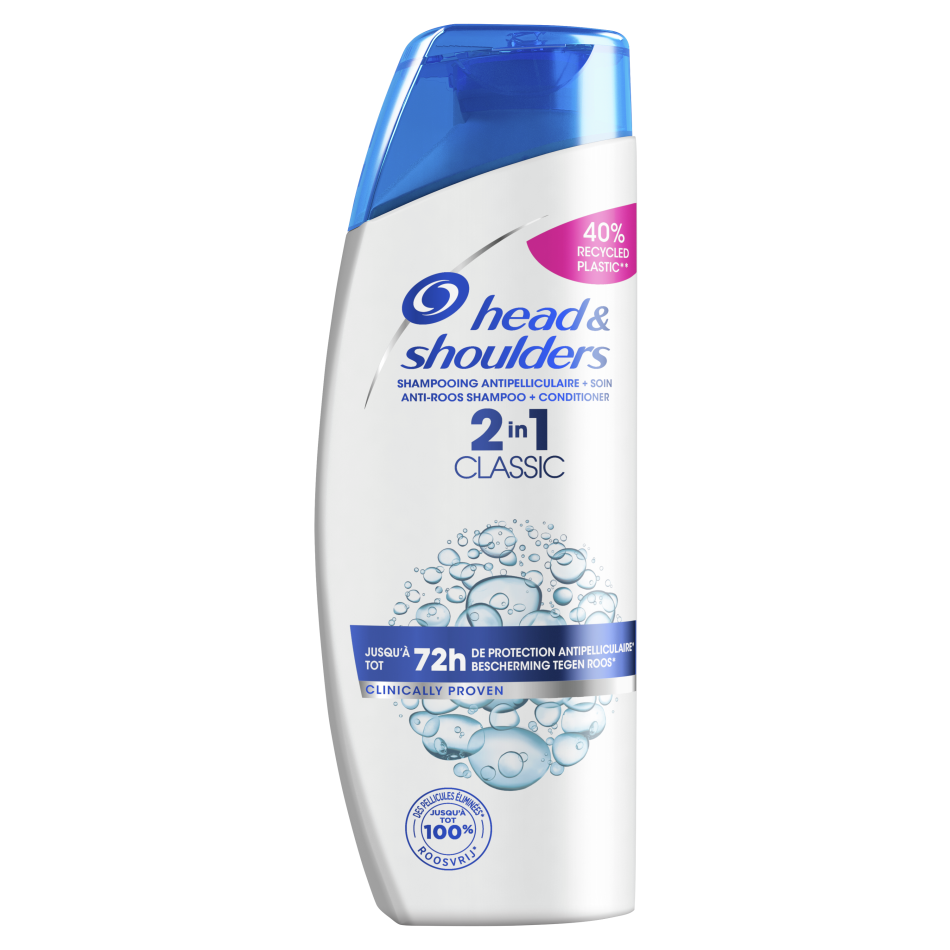 zondag genetisch Ontslag Hoe krijg je roos? - De oorzaken uitgelegd | Head&Shoulders NL