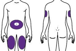 choose-injection-site