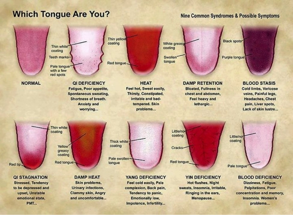 Tongue diagnosis chart used in TCM