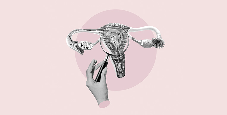 hipermenorrea-cl-interna-1